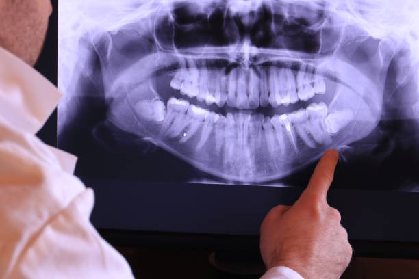 Best Emergency Dentist for Knocked-Out Tooth in Mountain City, TN