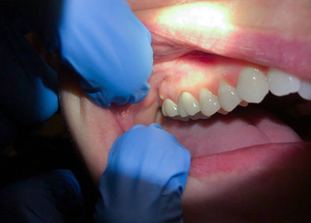 Best Orthodontic Emergency Dentist in Mountain City, TN