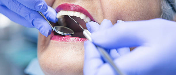 Best Emergency Dentist for Lost Fillings or Crowns in Mountain City, TN
